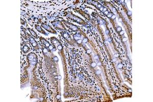 IHC analysis of Histone H1. (Histone H1 antibody  (AA 20-159))