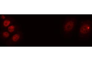 ABIN6276654 staining A549 cells by ICC/IF. (BDNF antibody  (Internal Region))