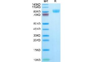 IL17RA Protein (AA 33-320) (Fc Tag)