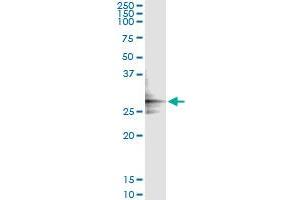 Immunoprecipitation of GLUD2 transfected lysate using anti-GLUD2 monoclonal antibody and Protein A Magnetic Bead , and immunoblotted with GLUD2 MaxPab rabbit polyclonal antibody. (GLUD2 antibody  (AA 1-264))