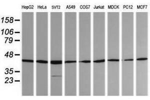 Image no. 2 for anti-Mitogen-Activated Protein Kinase Kinase 1 (MAP2K1) antibody (ABIN1499396) (MEK1 antibody)