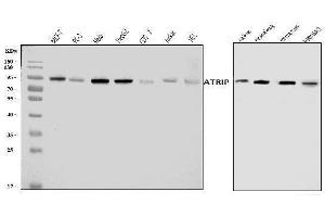 Western blot analysis of ATRIP using anti-ATRIP antibody (ABIN7599701).