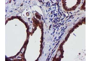 Immunohistochemical staining of paraffin-embedded Human breast tissue using anti-EPN2 mouse monoclonal antibody.