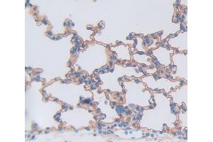 Used in DAB staining on fromalin fixed paraffin- embedded Kidney tissue (DcR1 antibody  (AA 32-244))