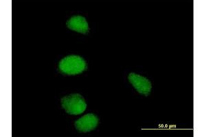 Immunofluorescence of purified MaxPab antibody to CCNE1 on HeLa cell. (Cyclin E1 antibody  (AA 1-410))