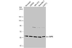 WB Image Various whole cell extracts (30 μg) were separated by 7. (Glucose-6-Phosphate Dehydrogenase antibody)