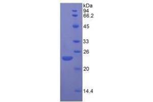 Image no. 3 for Fibroblast Growth Factor 13 (FGF13) (AA 1-192) (Active) protein (His tag) (ABIN6239865)