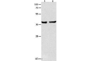 Western blot analysis of Mouse esophagus and human cervical cancer tissue , using SERPINB5 Polyclonal Antibody at dilution of 1:1000