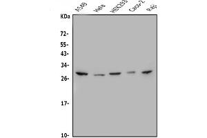 Western blot analysis of MESP1 using anti-MESP1 antibody (ABIN7599189).
