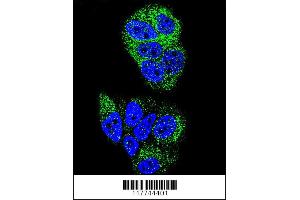 Confocal immunofluorescent analysis of HNF4A Antibody with MCF-7 cell followed by Alexa Fluor 488-conjugated goat anti-rabbit lgG (green). (HNF4A antibody  (N-Term))