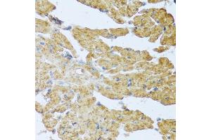 Immunohistochemistry of paraffin-embedded mouse heart using IL20 antibody (ABIN5973987) at dilution of 1/100 (40x lens).