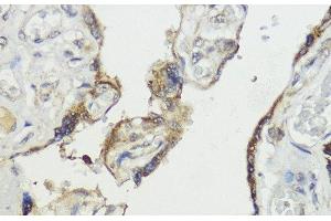 Immunohistochemistry (Paraffin-embedded Sections) (IHC (p)) image for anti-HECT Domain and Ankyrin Repeat Containing, E3 Ubiquitin Protein Ligase 1 (HACE1) antibody (ABIN7264832)
