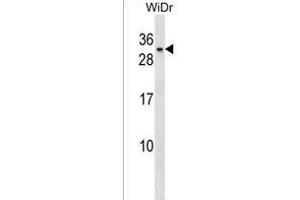 BHLHA9 Antibody (Center) (ABIN1538494 and ABIN2850208) western blot analysis in WiDr cell line lysates (35 μg/lane). (BHLHA9 antibody  (AA 57-83))