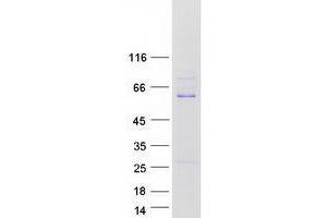 ZSCAN21 Protein (Myc-DYKDDDDK Tag)