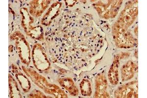 Immunohistochemistry of paraffin-embedded human kidney tissue using ABIN7173087 at dilution of 1:100 (TMEM161B antibody  (AA 1-487))