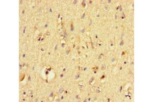 Immunohistochemistry of paraffin-embedded human brain tissue using ABIN7161472 at dilution of 1:100 (Neurotrypsin antibody  (AA 631-874))