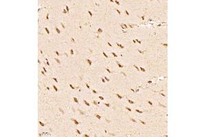 Immunohistochemistry of paraffin embedded rat brain using RBAK (ABIN7075383) at dilution of 1:1000 (400x lens) (RBAK antibody)