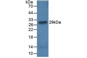 Western blot analysis of recombinant Rat CFH. (Complement Factor H antibody  (AA 975-1217))