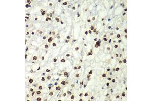 Immunohistochemistry (Paraffin-embedded Sections) (IHC (p)) image for anti-Splicing Factor 3b, Subunit 2, 145kDa (SF3B2) (AA 616-895) antibody (ABIN6147666)