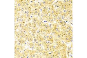 Immunohistochemistry (IHC) image for anti-Wilms Tumor 1 (WT1) (AA 1-302) antibody (ABIN6215537) (WT1 antibody  (AA 1-302))