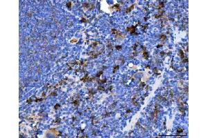 IHC analysis of TXNDC5 using anti-TXNDC5 antibody (ABIN7599699). (TXNDC5 antibody  (AA 109-403))