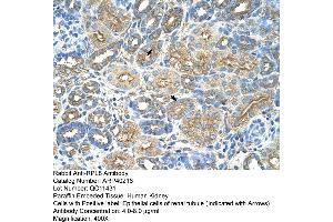 Rabbit Anti-RPL8 Antibody  Paraffin Embedded Tissue: Human Kidney Cellular Data: Epithelial cells of renal tubule Antibody Concentration: 4. (RPL8 antibody  (C-Term))