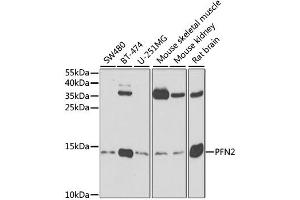 Western blot analysis of extracts of various cell lines, using PFN2 antibody.