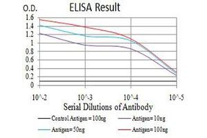 Black line: Control Antigen (100 ng),Purple line: Antigen (10 ng), Blue line: Antigen (50 ng), Red line:Antigen (100 ng) (eIF4EBP1 antibody  (pSer65))
