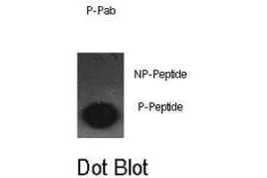 Dot blot analysis of JUN (phospho S63) polyclonal antibody  on nitrocellulose membrane.