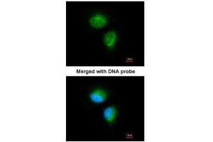 ICC/IF Image Immunofluorescence analysis of paraformaldehyde-fixed HeLa, using MMACHC, antibody at 1:100 dilution. (MMACHC antibody  (Center))