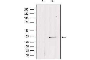 Western blot analysis of extracts from mouse lung, using SULT1E1 antibody. (SULT1E1 antibody  (Internal Region))