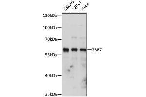 Western blot analysis of extracts of various cell lines, using GRB7 antibody. (GRB7 antibody)