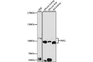Western blot analysis of extracts of various cell lines, using PKP2 antibody (ABIN6128554, ABIN6145717, ABIN6145718 and ABIN6221177) at 1:1000 dilution. (Plakophilin 2 antibody  (AA 578-837))