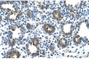 Human Lung (Glucuronidase beta antibody  (C-Term))