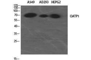 Western Blotting (WB) image for anti-Solute Carrier Organic Anion Transporter Family, Member 1A2 (SLCO1A2) (Internal Region) antibody (ABIN3176431) (SLCO1A2 antibody  (Internal Region))