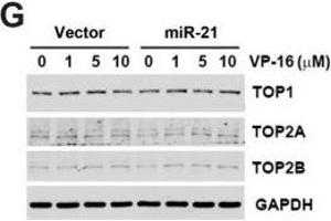 Effect of miR-21 overexpression on chemosensitivity. (Topoisomerase II alpha antibody  (C-Term))