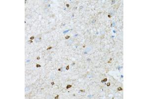Immunohistochemistry of paraffin-embedded mouse spinal cord using ROCK2 antibody (ABIN5973333) at dilution of 1/100 (40x lens).