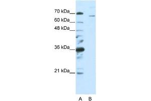 WB Suggested Anti-SF1  Antibody Titration: 0.