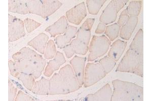 DAB staining on IHC-P; Samples: Rat Skeletal muscle Tissue (MYL6B antibody  (AA 6-137))
