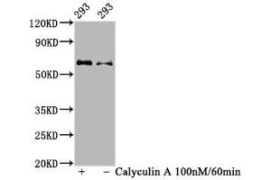 Western Blot Positive WB detected in 293 whole cell lysate(treated with Calyculin A or not) All lanes Phospho-AKT1 antibody at 1. (Recombinant AKT1 antibody  (pSer473))