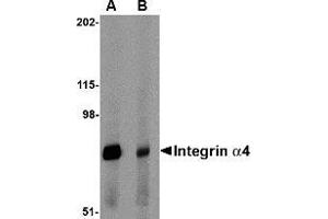 Western blot analysis of Integrin alpha 4 in rat spleen tissue lysate with Integrin alpha 4 antibody at 1 μg/ml in (A) the absence and (B) the presence of blocking peptide. (ITGA4 antibody  (Center))