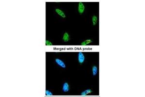 ICC/IF Image Immunofluorescence analysis of paraformaldehyde-fixed HeLa, using IPMK, antibody at 1:200 dilution. (IPMK antibody)