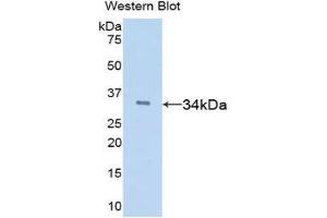 Western Blotting (WB) image for anti-Tissue Factor Pathway Inhibitor (Lipoprotein-Associated Coagulation Inhibitor) (TFPI) (AA 29-302) antibody (ABIN1078584) (TFPI antibody  (AA 29-302))