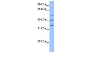 Image no. 1 for anti-Zinc Finger CCCH-Type Containing 14 (ZC3H14) (N-Term) antibody (ABIN6739430)