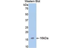 Western blot analysis of the recombinant protein. (TPSAB1 antibody  (AA 149-273))