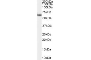 ABIN334412 (0. (GNRHR antibody  (Internal Region))