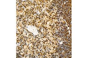 Immunohistochemistry (Paraffin-embedded Sections) (IHC (p)) image for anti-Transcription Factor 7 (T-Cell Specific, HMG-Box) (TCF7) antibody (ABIN7075952)