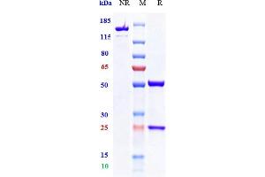 Anti-TIGIT Reference Antibody (vibostolimab) on SDS-PAGE under reducing (R) condition. (Recombinant TIGIT (Vibostolimab Biosimilar) antibody)