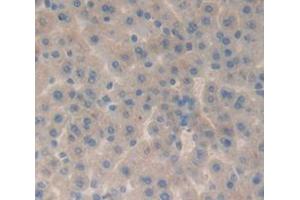 Immunohistochemistry (IHC) image for anti-alpha-2-HS-Glycoprotein (AHSG) (AA 19-250) antibody (ABIN1077779)