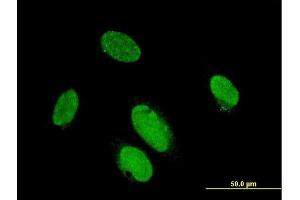 Immunofluorescence of monoclonal antibody to PITX2 on HeLa cell. (PITX2 antibody  (AA 1-324))